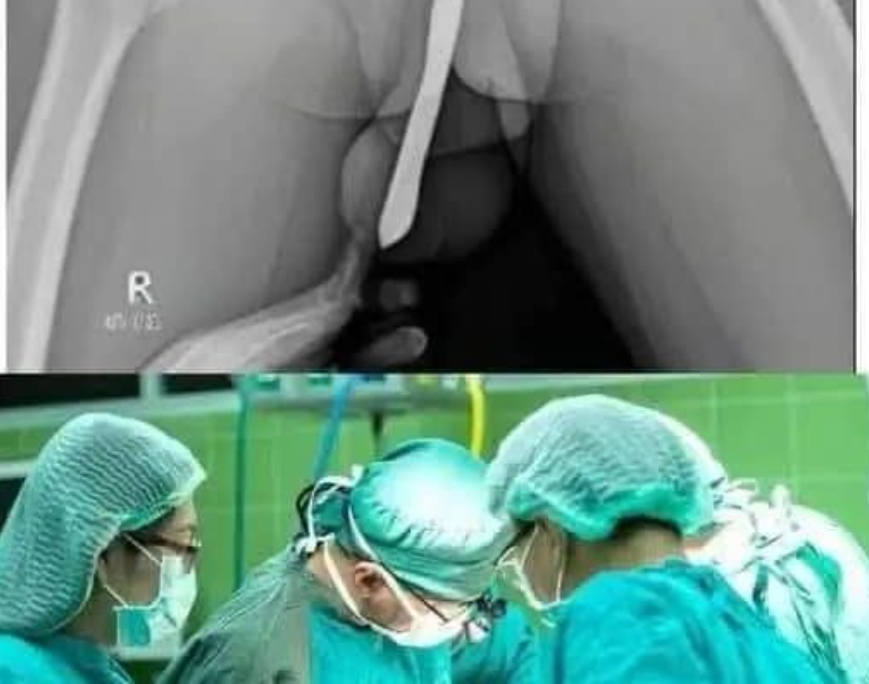 Doctors are speechless: Just boil these 2 ingredients and you will quickly lose your body fat !!